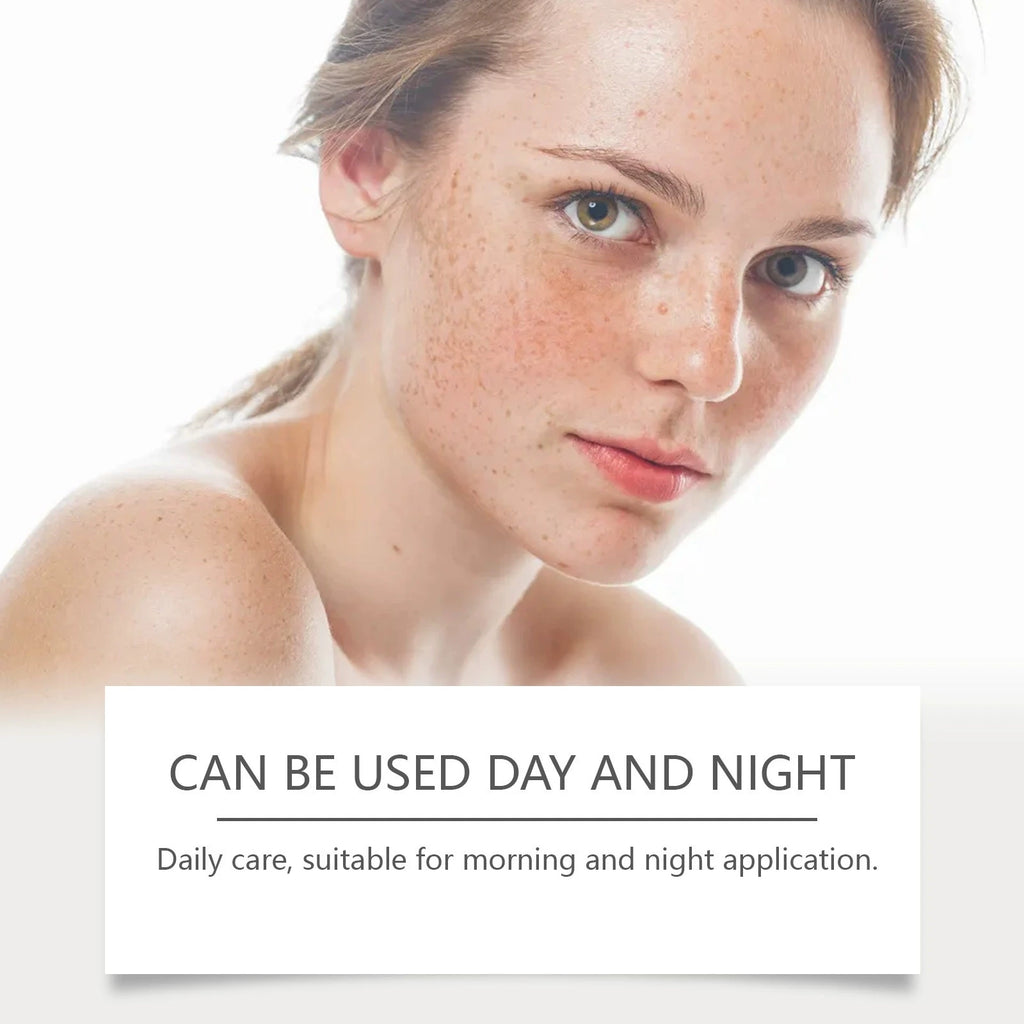 SADOER Anti-Sommersprossen-Creme, aufhellende Gesichtscreme, Anti-Aging-Feuchtigkeitspflege zur Entfernung von Pigmentflecken und Sommersprossen, Gesichtspflege