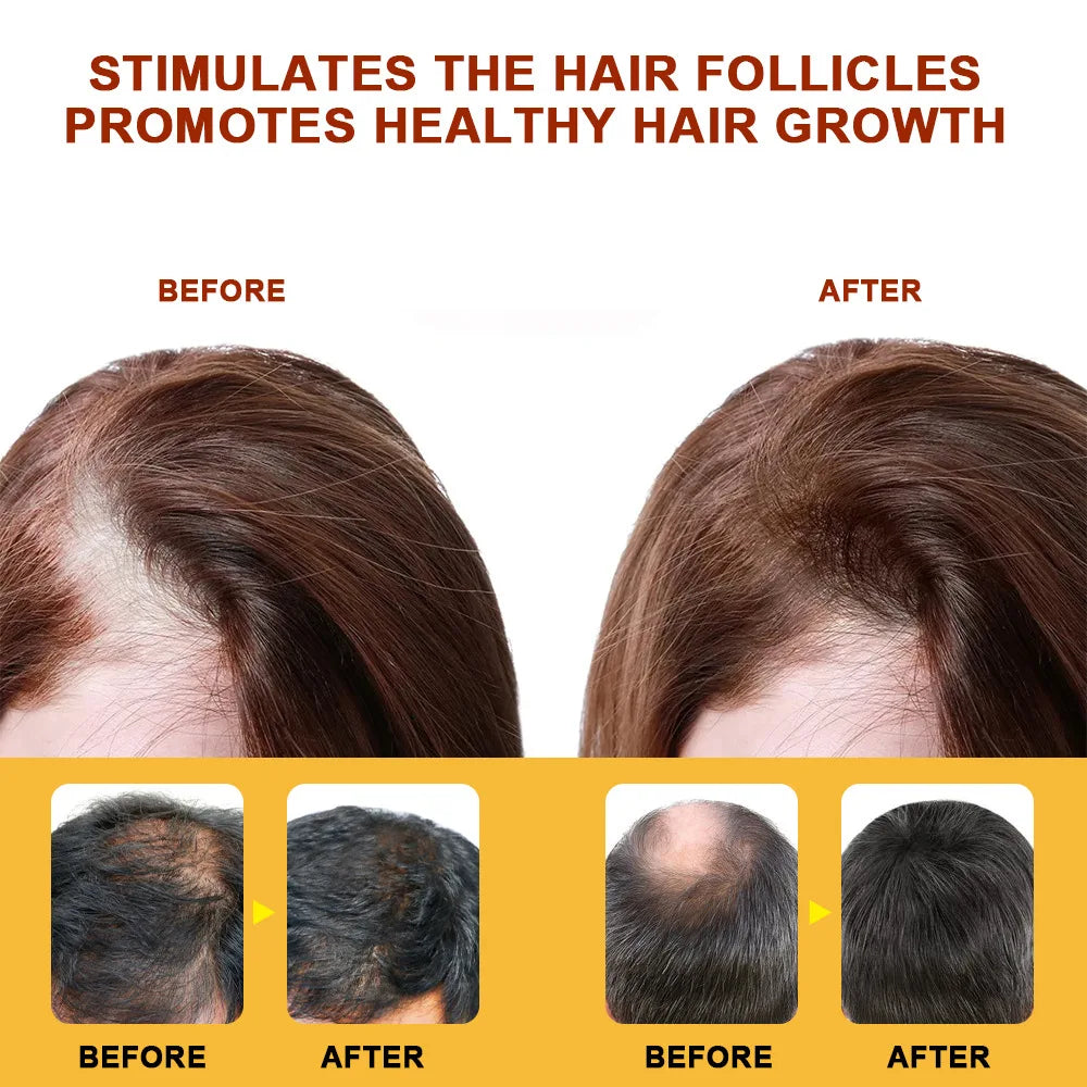 Hair Growth Cream Serum Fast Regrowth Essential Capsule Anti Hair Loss Baldness Reduce Damaged Scalp Treatment For Women Men